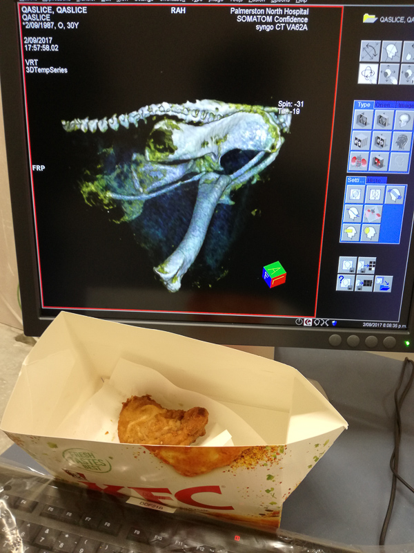 031 T StateOfTheArtPhantom